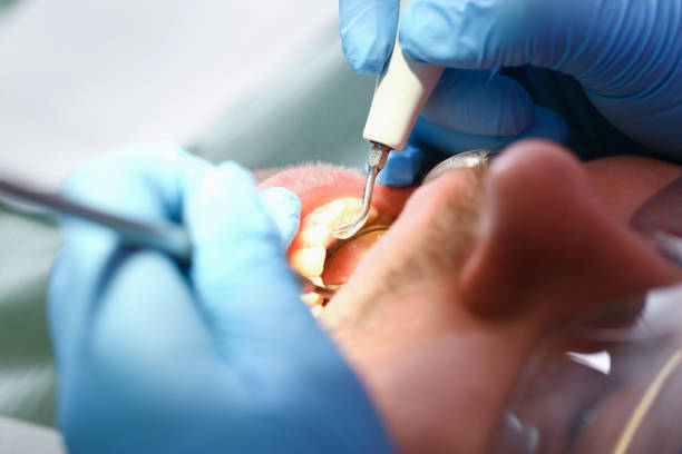 Best Pediatric Emergency Dentist in Onarga, IL