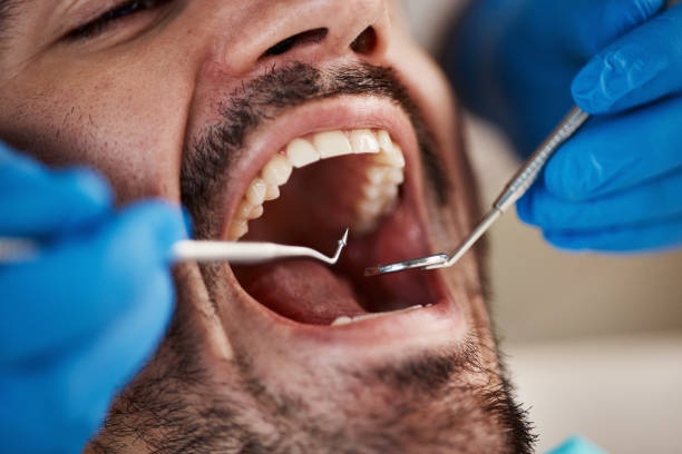Best Urgent Care for Lost Fillings or Crowns in Onarga, IL